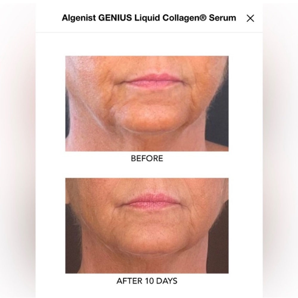 ALGENIST Bundle (4) - Picture 15 of 16